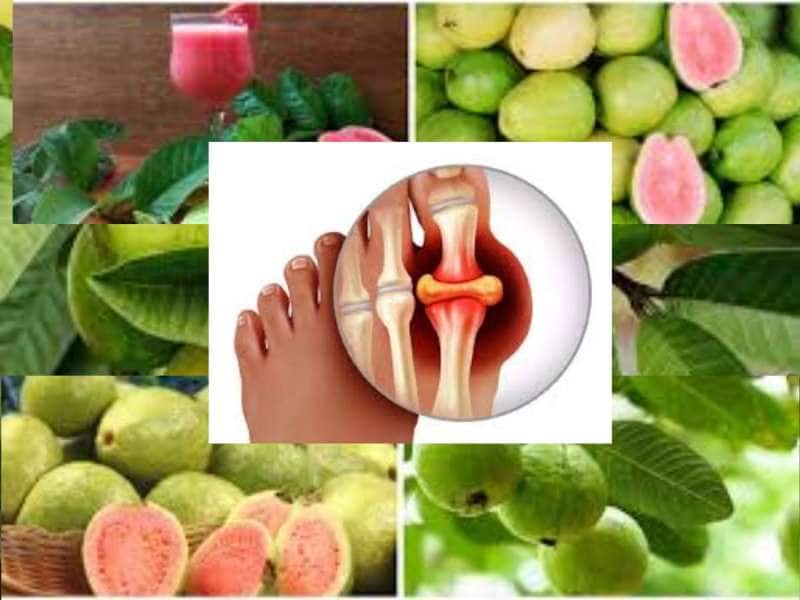 Guava vs Uric Acid: யூரிக் அமிலத்திற்கு சவால் விடும் கொய்யா இலைகள்! இது மூலிகையா?