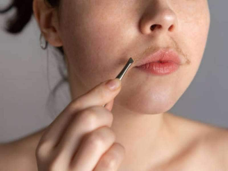 Facial Hair: முகத்தில் முடி வளருதா? ‘இந்த’ வைத்தியம் செய்தால் சரியாகும்!