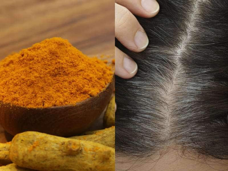 White Hair Problem: வீட்டில் உள்ள மஞ்சள் மூலம் நரை முடி பிரச்சனையை சரி செய்யலாம்! title=