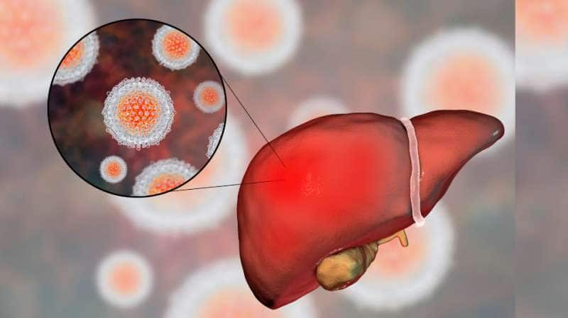 லிவரை காலி செய்யும்  Hepatitis B...அறிகுறிகளும்... வராமல் தடுக்க செய்ய வேண்டியதும்..!!