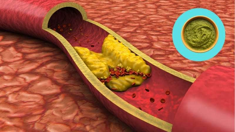 High Cholesterol: எகிறும் கொலஸ்ட்ராலை ஒழித்துக் கட்ட உதவும்... சில சட்னி வகைகள் title=