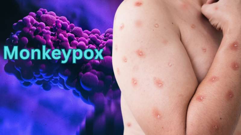 Monkeypox Virus: குரங்கு அம்மை அறிகுறிகளுடன் எய்ம்ஸ் வந்த நோயாளி... மருத்துவமனையில் பரபரப்பு