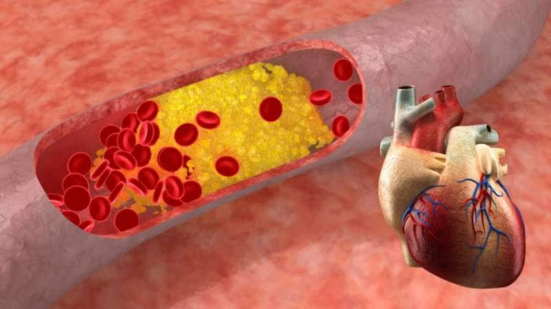 Blood Thinner Foods: இரத்தத்தை மெலித்து... மாரடைப்பை தடுக்கும் சிறந்த  உணவுகள்