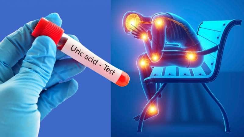 Uric Acid: எகிறும் யூரிக் அமிலத்தை விரட்டி அடிக்கும் சில மேஜிக்  இலைகள்