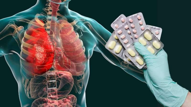 Nafithromycin: இந்தியாவின் முதல் ஆண்டி-பாயாடிக் மருந்து... நிமோனியா சிகிச்சையில் ஒரு புரட்சி
