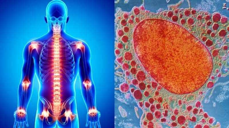 Anti-inflammatory Foods: உடல் அழற்சியை இயற்கையாக குறைத்து... வலியை போக்கும் சூப்பர் உணவுகள்