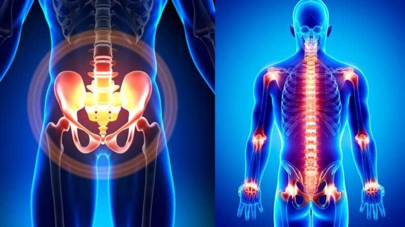 40+ வயதாகிவிட்டதா... மூட்டு வலி பிரச்சனை வராமல் இருக்க உணவில் சேர்க்க வேண்டியவை