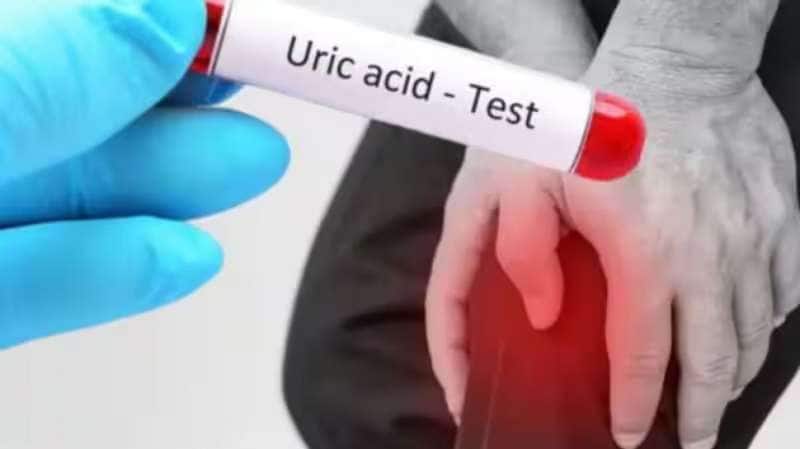 யூரிக் அமிலம் அதிகமாய் இருந்தால், தயிரும் இந்த உணவுகளும் வேண்டவே வேண்டாம்
