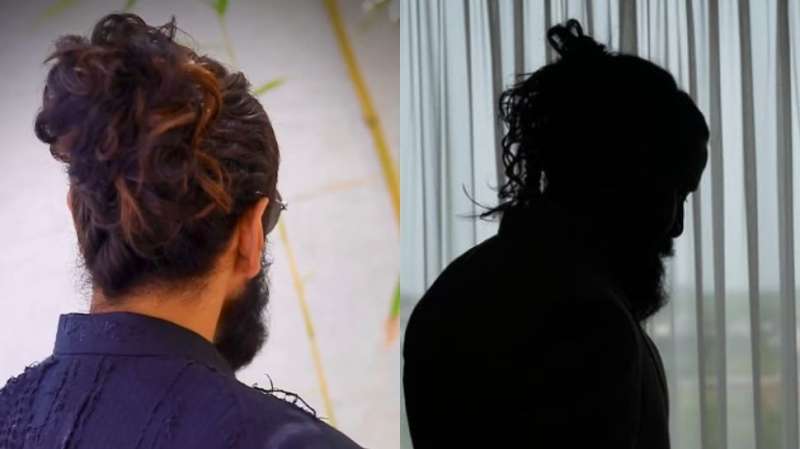 23 சர்ஜரி, 3 வருஷ ஹாஸ்பிட்டல் வாழ்க்கை! இப்போ டாப் ஹீரோவாக இருக்கும் நடிகர்..