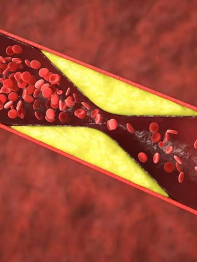 cholestrol control